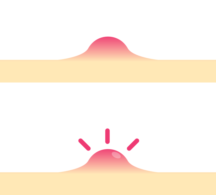  [건강] 마스크로 인한 뾰루지 / 피부 트러블 피부관리