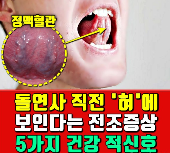 돌연사 직전 혀에 보인다는 전조증상, 5가지 건강 적신호 돌연사 직전 혀에 보인다는 전조증상, 5가지 건강 적신호