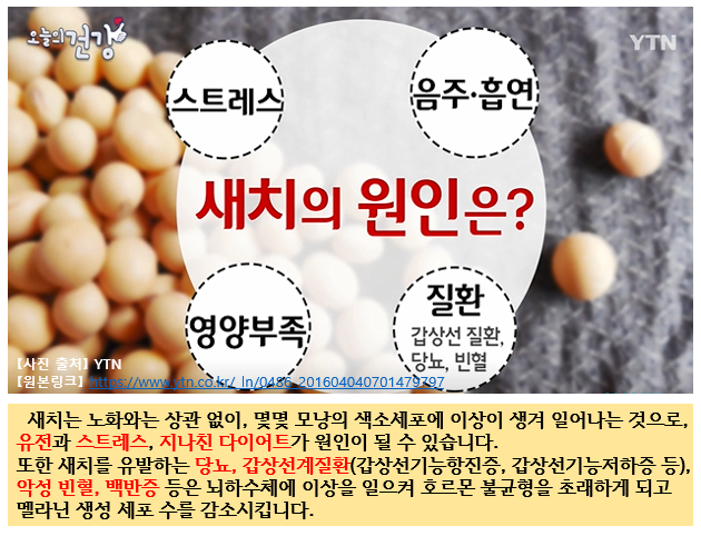  새치 원인 예방과 관리방법 알아봅시다