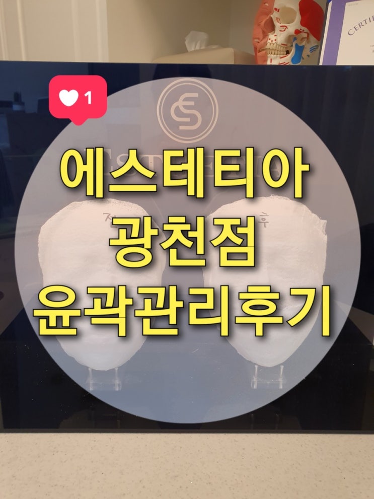  광주 윤곽관리 잘하는 광천동 에스테틱 "에스테티아" 춤추는 윤곽관리 1회 후기