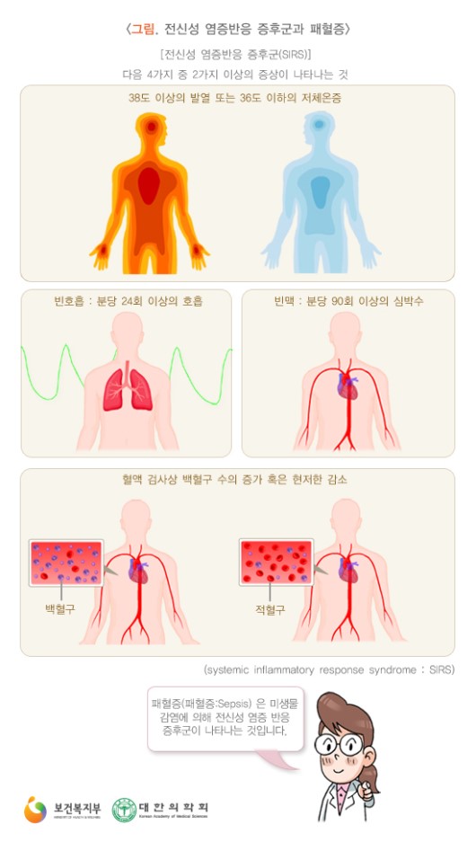  [급성 패혈증이란?] 그 증상과 원인, 싸이토카인 폭풍 -2