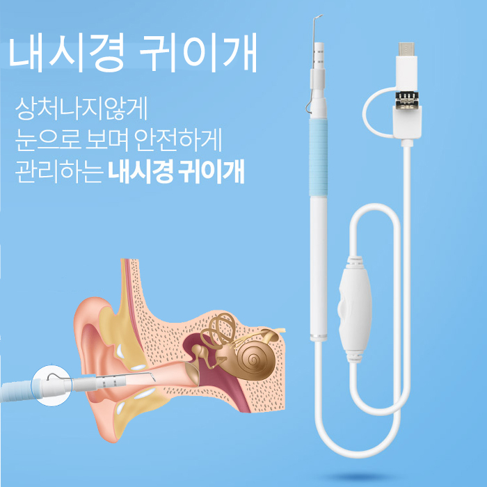 샤오미 홍미4X/4A 귀내시경/내시경귀이개/귀후비개/ 내시경카메라, BF206 귀이개 추천해요