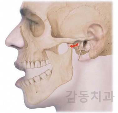  당감동턱관절장애증상이있으면감동치과로!