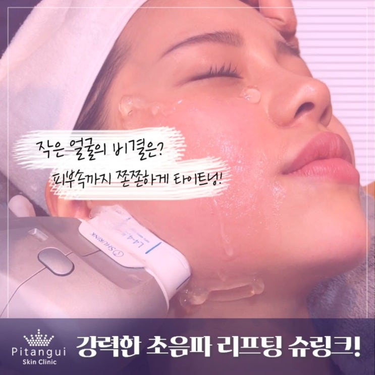  V라인만들기! 슈링크리프팅300샷 + 스킨보톡스 + 윤곽주사