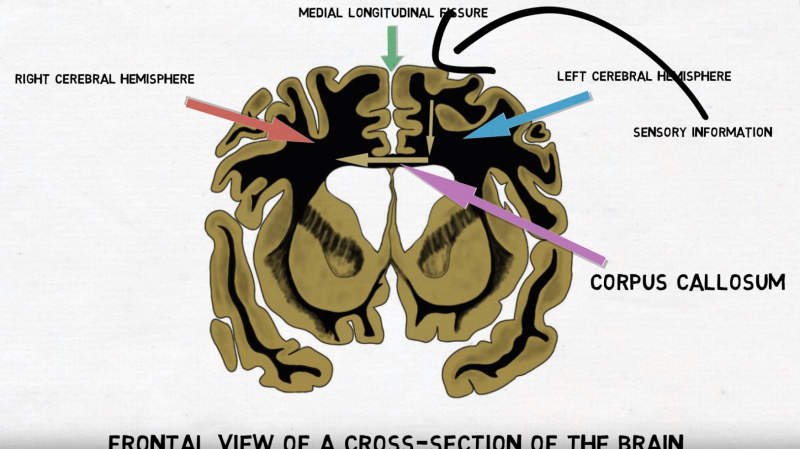 corpus callosum 뇌량 : 네이버 블로그