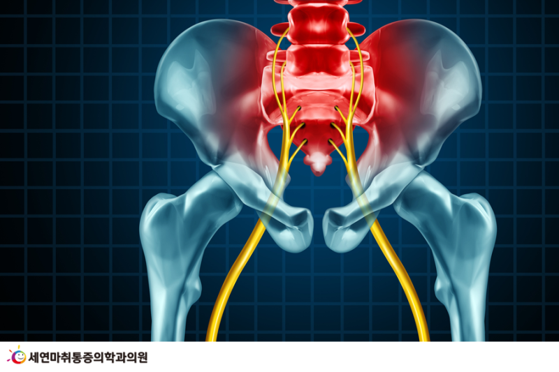 출산후 골반통증 왜 생길까? 2