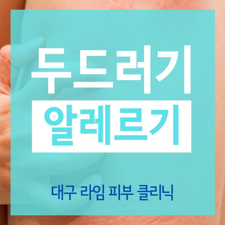  [대구 동구 라임 비뇨기과 피부과] 도대체 두드러기와 알레르기는 왜 생기는 걸까요??