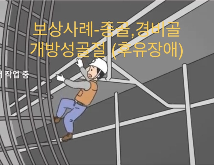  [보상사례]-개방성골절-경비골,종골 후유장해