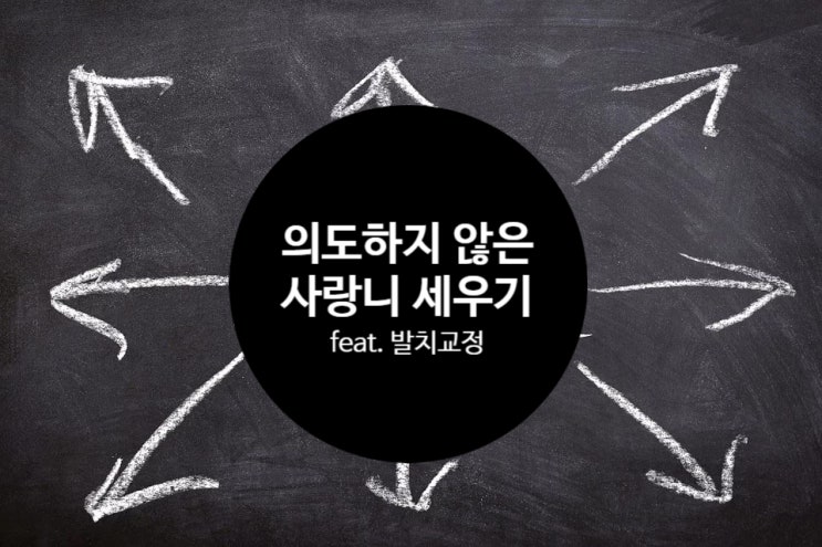 누워있던 사랑니 똑바로 서고 있네!!! (Feat. 발치교정) 누워있던 사랑니 똑바로 서고 있네!!! (Feat. 발치교정)