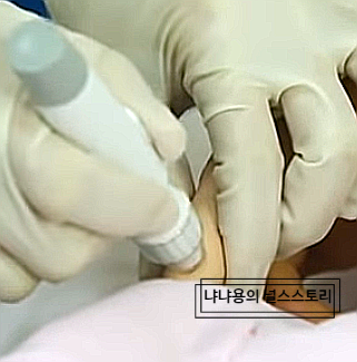 <널스스토리> 신규간호사 의학용어 ㅡ BST(혈당) 정상범위, 혈당측정법, 혈당검사 <널스스토리> 신규간호사 의학용어 ㅡ BST(혈당) 정상범위, 혈당측정법, 혈당검사