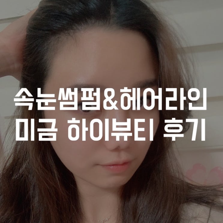  분당 속눈썹펌 하이뷰티 헤어라인 시술 후기 (미금역 헤어라인, 자연눈썹, 아이라인, 왁싱 가격)
