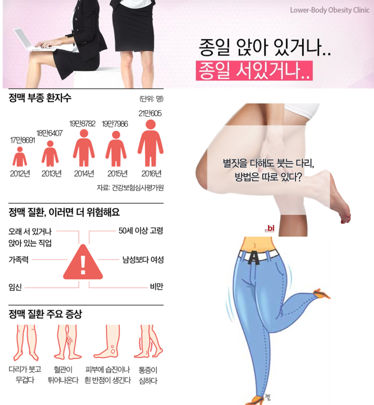  코끼리 다리