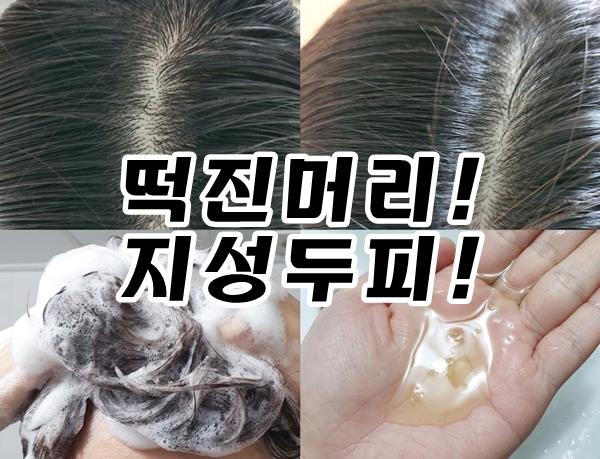  지성두피샴푸 올리브영샴푸 클로란 떡진 머리 탈출 성공