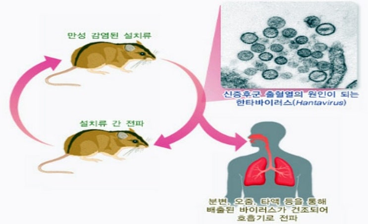  중국 한타바이러스 감염자 사망. 한타바이러스란 무엇인가?