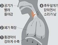  신생아 아기 딸꾹질 멈추는법, 원인을 알아봅시다