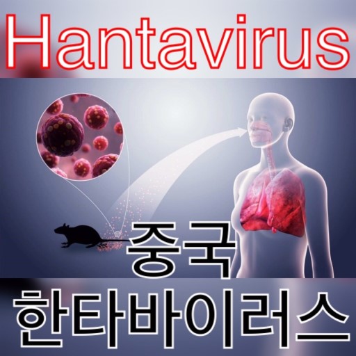 중국 한타바이러스1명사망 쥐고기.한타바이러스란?hantavirus증상
