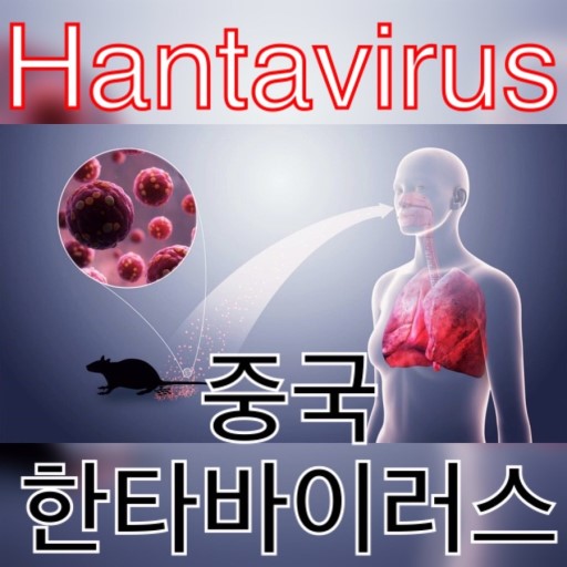 중국 한타바이러스1명사망 쥐고기.한타바이러스란?hantavirus증상