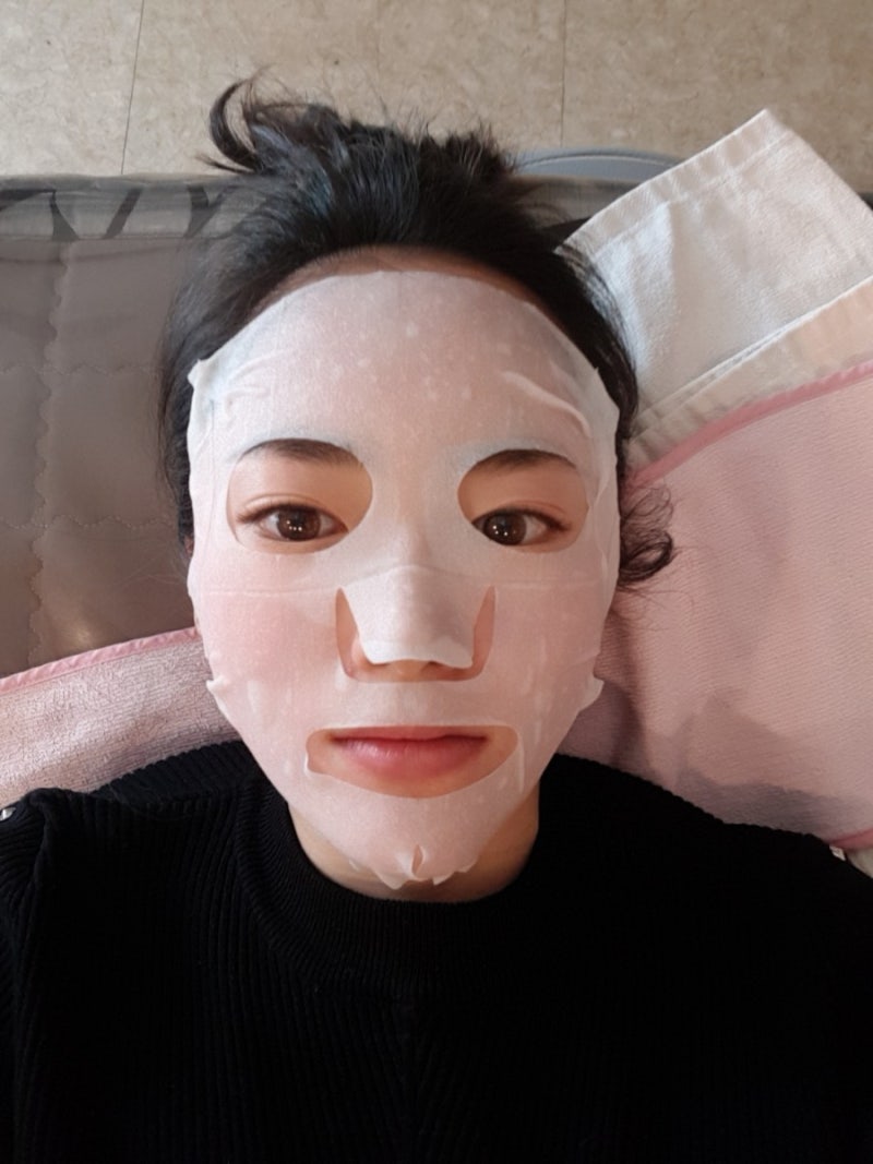 서울 종로피부과 VRM 레이저토닝, 색소침착관리 2차 리뷰 및 경과 8