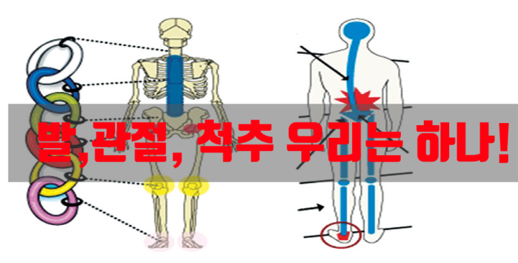  자세 체형교정 힘든 운동 대신 기능성건강신발 추천