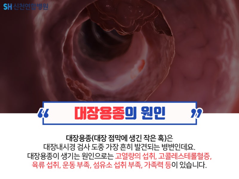 신중동 대장용종제거 중요한 7