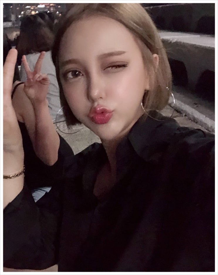  압구정눈재수술 이제 고민 끝이예요