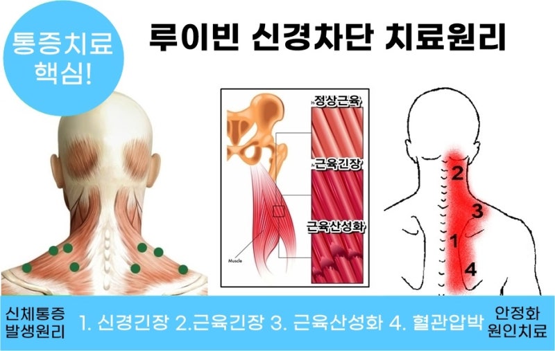 5분 뒷목통증두통, 목디스크증상 완화운동법(#목디스크턱관절) : 네이버 블로그 5분 뒷목통증두통, 목디스크증상 완화운동법(#목디스크턱관절) : 네이버 블로그