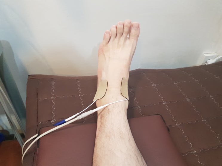 수원 발목 염좌, 영통 한의원에서 통증 치료 받으세요 수원 발목 염좌, 영통 한의원에서 통증 치료 받으세요