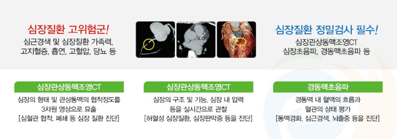 부산 심근경색 증상 심근경색 검사 / 원인과 치료방법 / 구포성심병원 순환기내과 5