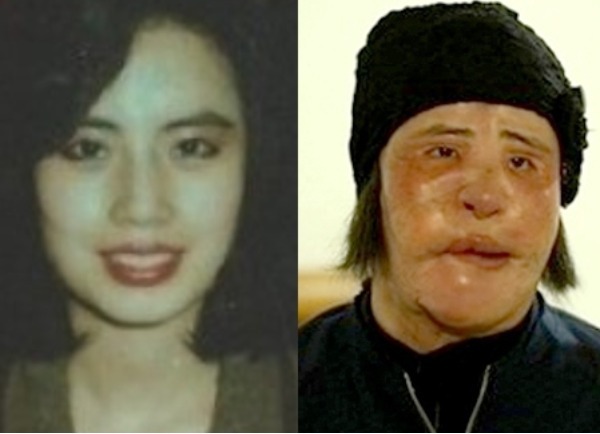 선풍기 아줌마 사망 나이 원인 이유 사유 자살 성형전후 수술 사진 선풍기 아줌마 사망 나이 원인 이유 사유 자살 성형전후 수술 사진