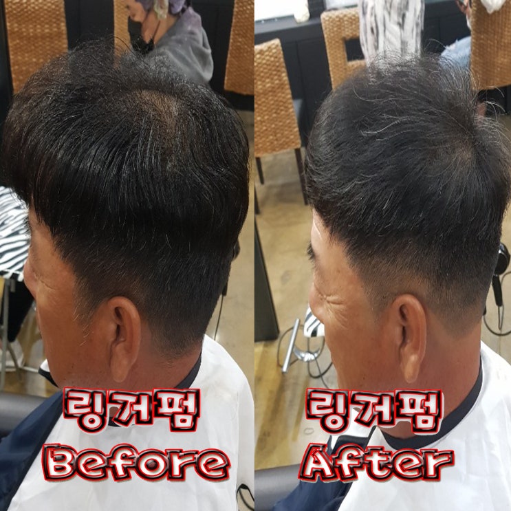  링거펌으로 회춘하세요!! 60대 아버님 링거펌 후기 #헤어벅스 #수원정자동미용실