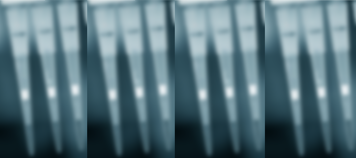  코로나 치료제 투약 결정 FDA3상 승인