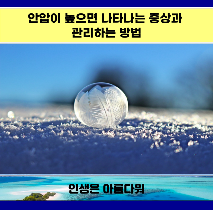  안압이 높으면 나타나는 증상과 관리하는 방법