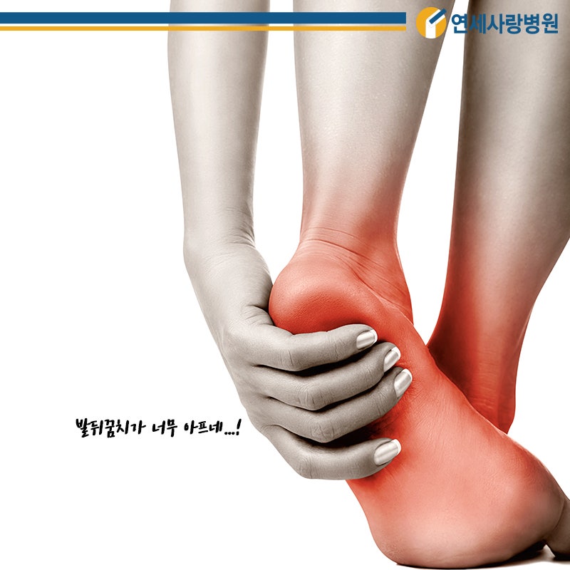 발목인대수술(MBO)후 아킬레스건염재활<병상일지>105/아킬레스건부착부 내측외측통증/절대숨김 스포츠테이프종류