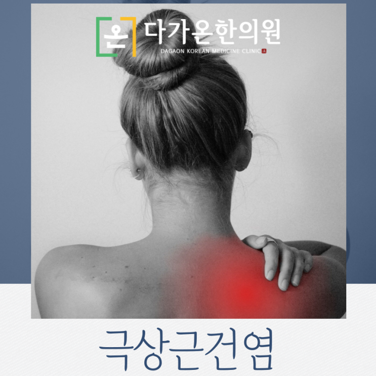 까치산역 한의원 극상근건염 원인과 증상에 대해 알려드립니다
