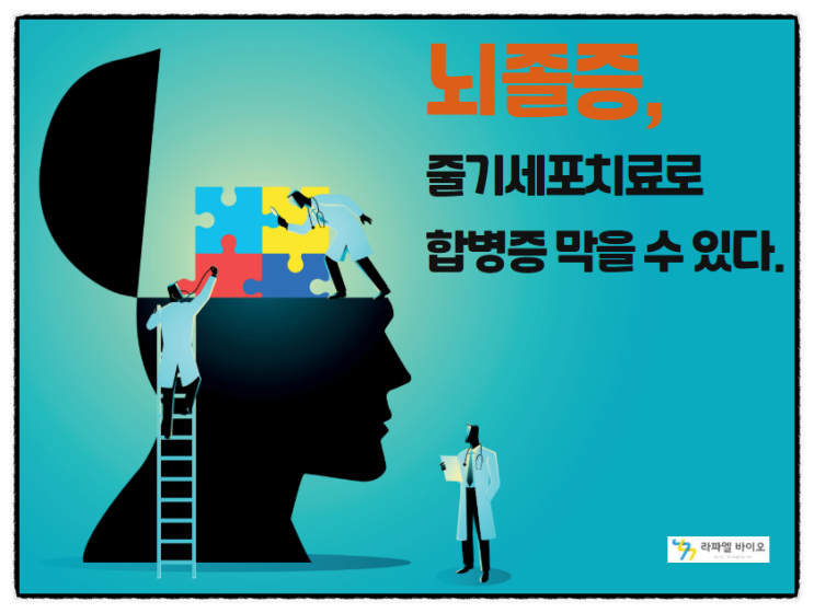  뇌졸증을 줄기세포치료로 합병증 막을 수 있다.