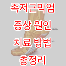  족저근막염 증상 원인 치료 방법 총정리