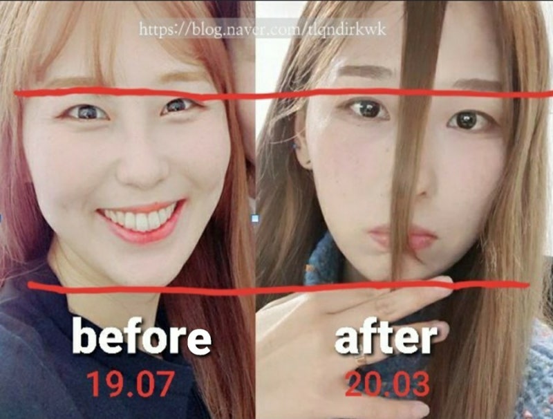 앞머리 기르기 한달차 비교