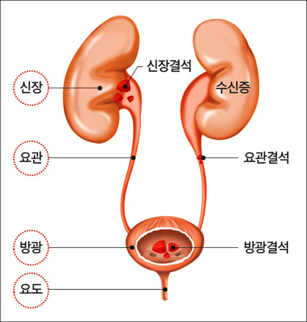 여자 왼쪽 아랫배 통증 원인은? (ft. 남자 아랫배통증 묵직 콕콕 ) : 네이버 블로그 여자 왼쪽 아랫배 통증 원인은? (Ft. 남자 아랫배통증 묵직 콕콕 ) : 네이버 블로그