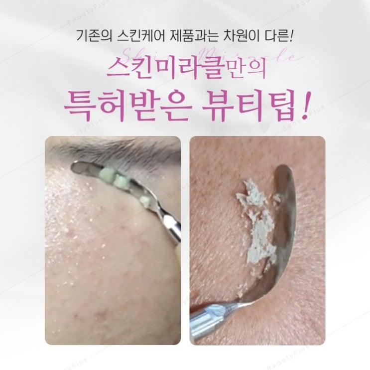 [봉곡동피부관리]봉곡동피부관리실 마실뷰티 피지제거,죽은각질제거는 스킨미라클이답이다~