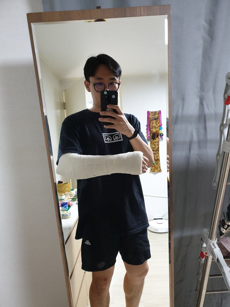 손목 골절 후기 (ㅠㅠ) 손목 골절 후기 (ㅠㅠ)