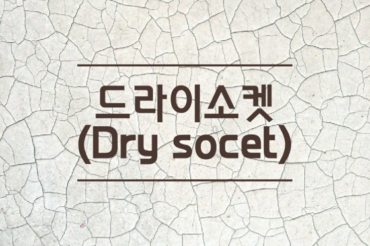  드라이소켓 ) 치과위생사가 알려주는 사랑니 발치 후 합병증
