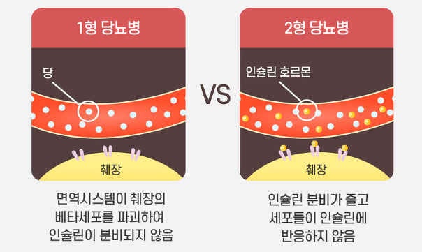 당뇨 초기증상 및 혈당 정상 2