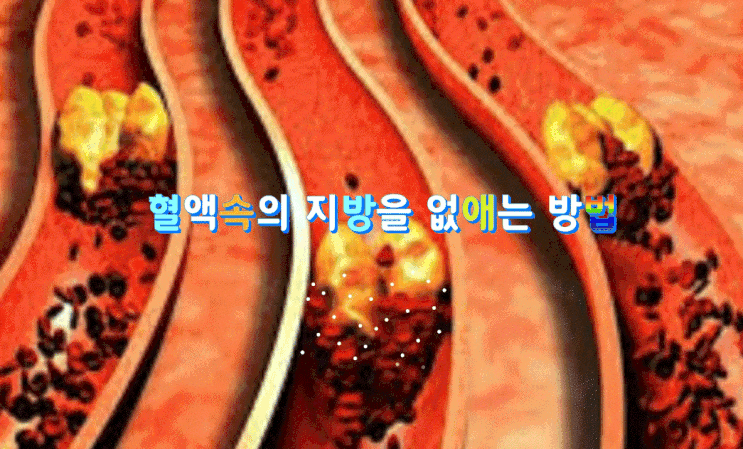 염증과 심혈관 건강을 지킬 수있는 혈액속의 지방을 없애는 방법은? 염증과 심혈관 건강을 지킬 수있는 혈액속의 지방을 없애는 방법은?