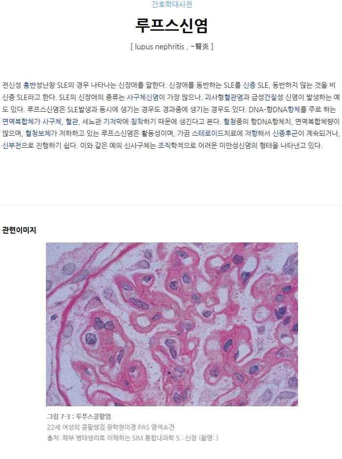  중증루프스신염 진단비 알아보기