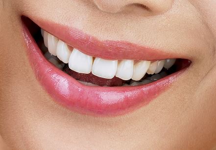 원데이 치아미백 프로그램으로 하루에 미백 치료를 끝낸다.