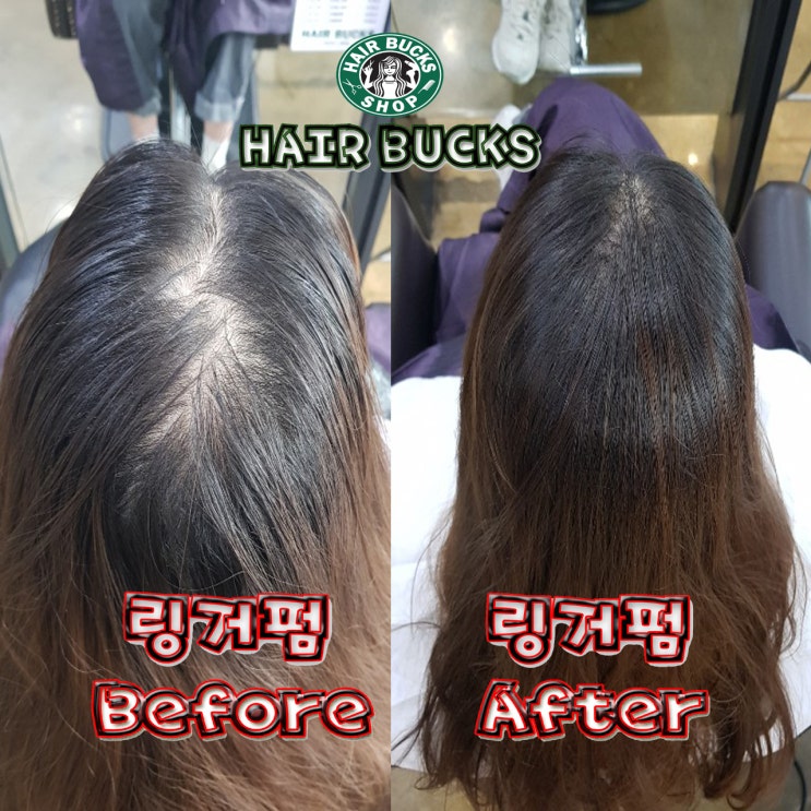  수원링거펌전문 헤어벅스에서 모류교정 시술후기