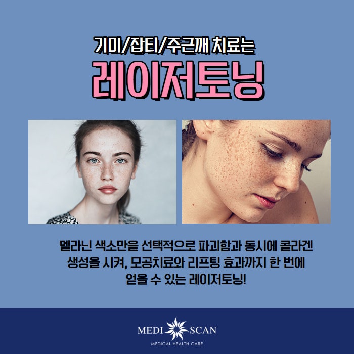 강남레이저토닝, 일단 멈추세요!