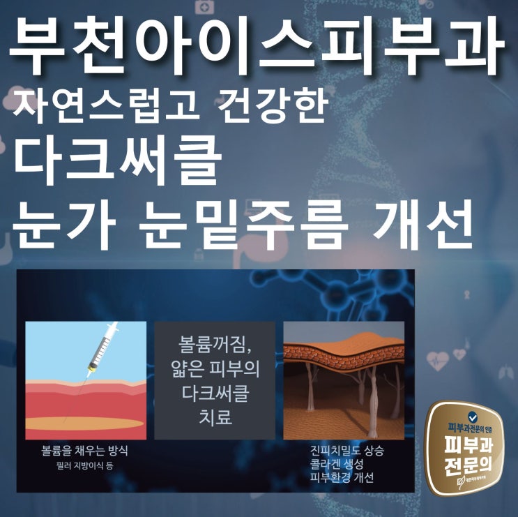  다크써클 눈가주름 필러 수술없이 관리 부천 리쥬란힐러