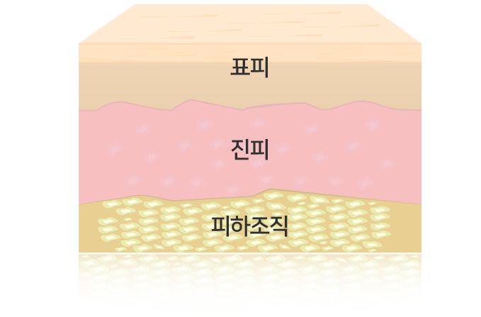 세르모 이미지