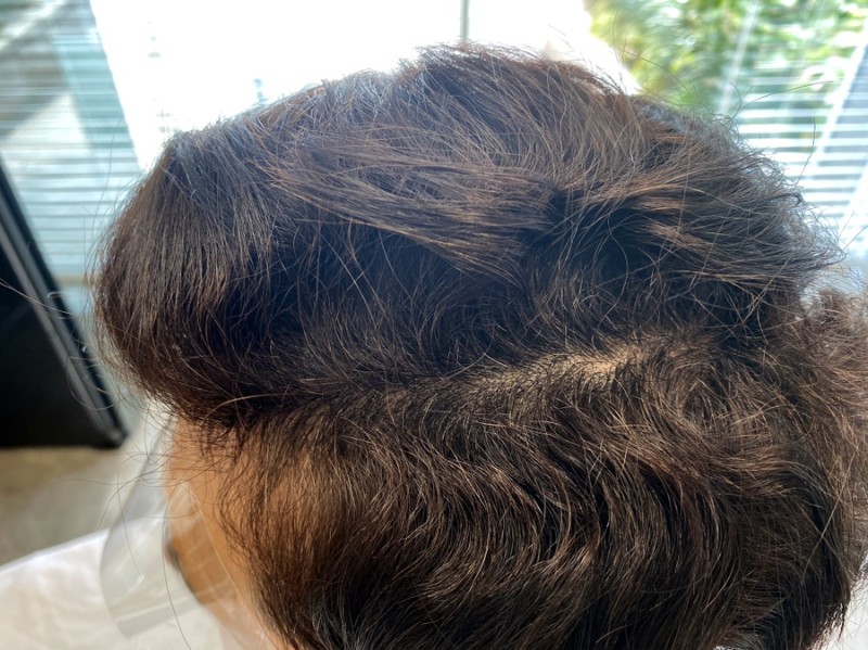남자 악성곱슬 매직 후 머리감기 : 네이버 블로그